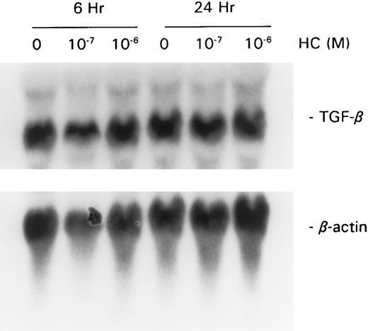 Fig. 4. Effect of GC on TGF-β mRNA. The assays were performed as described in Fig 3. The membranes were probed with full-length TGF-β1 and β-actin cDNA.