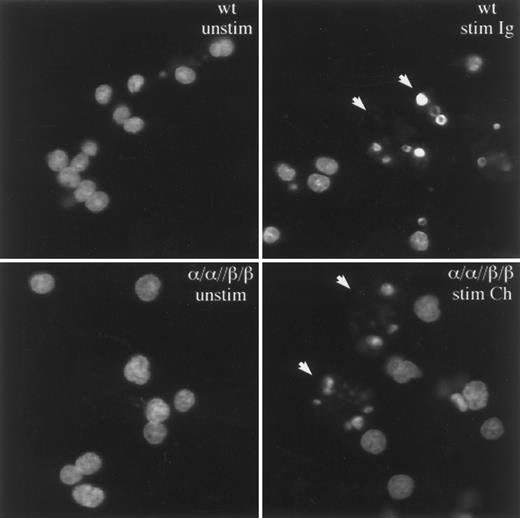 Fig. 3. Igα and Igβ induce death by apoptosis. Stimulation of α/α//β/β or the BCR on wt cells induces nuclear changes characteristic of apoptosis. The nuclei from nonapoptotic cells stain diffusely with acridine orange, whereas nuclei from apoptotic cells stain intensely for condensed chromatin bodies (denoted by arrows).