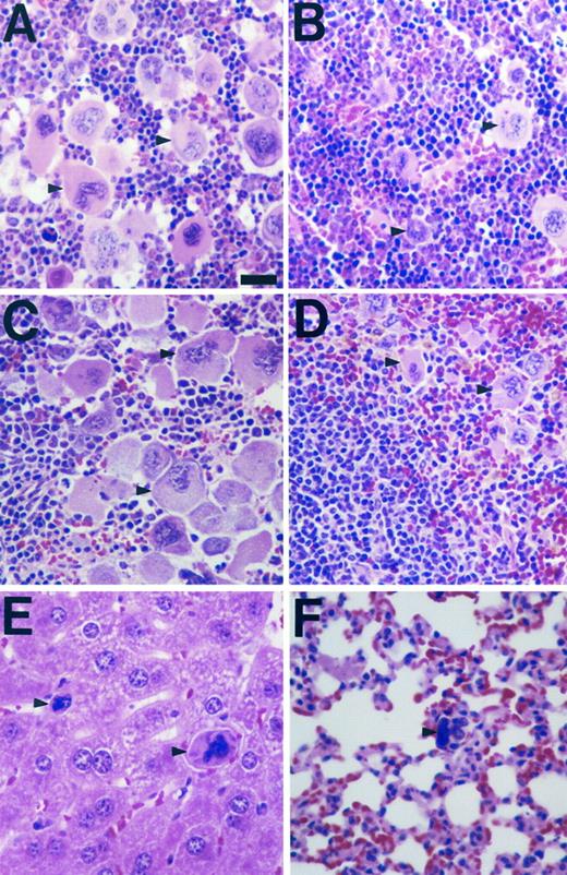 Fig. 5. Megakaryocytosis in transgenic mice. Four-micron formalin-fixed sections from AM107 (A, C, E, and F ) and control (B and D) tissues were stained with hematoxylin and eosin and photographed at 400× magnification. (A, B) Bone marrow; (C, D) spleen; (E) liver; (F ) lung. Representative megakaryocytes (megakaryocyte nucleus in lung) are indicated by arrowheads. Bar = 22 μm.