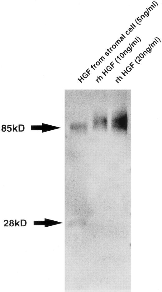 Fig. 2. Western blot analysis of HGF from stromal cells. Molecular weight is shown by arrows at left. Bands of 85 and 28 kD correspond to native and variant HGF, respectively.