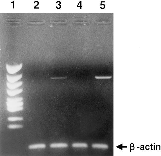 Fig. 6. RT-PCR analysis of c-MET gene expression. Lane 1, size marker; lane 2, CD34+ cells; lane 3, BM mononuclear cells; lane 4, MOLT4 (T-cell leukemia cells), negative control; lane 5, HUT78 (T-cell leukemia cells), positive control. To clarify cDNA quality, PCR products of the β-actin gene are presented below each lane.