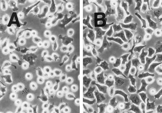 Fig. 4. SLF induces cell spreading of adherent TF-1 on fibronectin-coated wells. TF-1 cells were plated on fibronectin-coated wells and incubated for 15 minutes at 37°C. Wells were washed twice with RPMI-BSA medium. The medium without SLF (A), or with SLF (10 ng/mL) (B) was added to the wells and the wells were further incubated for 10 minutes before being photographed at 400 × magnification.