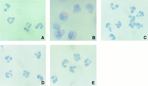 Fig. 7. High-power (original magnification × 400) photomicrographs of immunolocalization of neutrophil-derived COX-2 protein. Human neutrophils (1 × 107 cells) were cultured for 18 hours with 10 ng/mL of IL-10 or IL-4 in the presence or absence of LPS (100 ng/mL). The cells were deposited on a glass slide and stained with anti–COX-2 MoAb (A, medium; B, LPS; C, LPS + IL-4; D, LPS + IL-10) or control antibody (E).