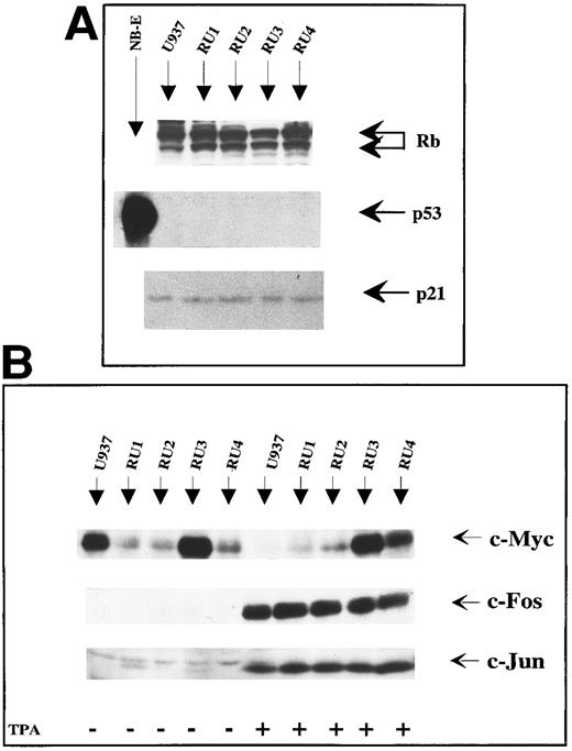 Fig. 3. Immunoblot analysis of tumor suppressor gene and oncogene products. (A) Comparison of U937 and RU cells for steady-state levels of the tumor suppressor gene products RB, p53, and p21. After cell lysis in RIPA buffer, 50 μg of total proteins were separated by SDS-PAGE and electrotransferred onto polyvinylidene difluoride membranes. Indicated proteins were detected by means of specific antibodies (1 μg/mL), and revealed by ECL after treatment with horseradish peroxidase-conjugated second antibody. The NB-E cell line was included as control for endogenous p53 protein production. (B) Effect of TPA on the production of c-Myc, c-Fos, and c-Jun oncoproteins in U937 and RU cells. Cultures (107 cells) were grown in the presence (+) or absence (−) of TPA (50 ng/mL) for 36 hours and processed for immunobloting as described in (A), using antibodies specific for the indicated proteins.