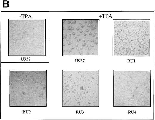 Fig. 5. Effect of TPA on the maturation of U937 and RU cells. (A) Cultures (5 × 105 cells) were grown in 5 mL of complete medium for 48 hours, in the absence (upper part) or presence (lower part) of 50 ng/mL of TPA, and harvested. Cell-surface antigen display and NAE activity were determined as described in Materials and Methods. Results shown are average values from three independent experiments (SD < 20%). (B) Homotypic aggregation of cells was visualized by phase contrast microscopy after incubation for 48 hours with TPA. U937 and RU cultures were indistinguishable from each other in the absence of TPA.