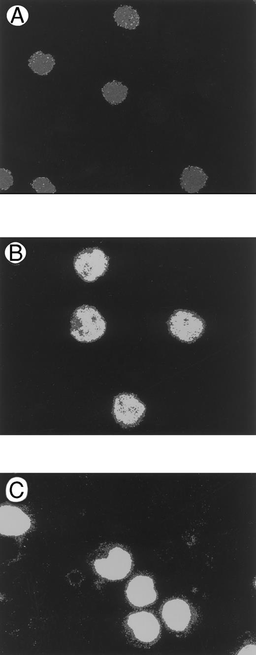 Fig. 8. Analysis of c-Fos protein performed in Jurkat cells by indirect immunofluorescence and revealed by confocal microscopy. The presence of c-Fos was evaluated in 24-hour serum–starved cells before (A) and after a 45-minute treatment with 15% FCS (B) or Tat plus 15% FCS (C).