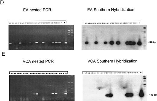 Fig. 2. Nested PCR screening and probe hybridization for BZLF1 (B), BRLF1 (C), BALF2 (D), and BcLF1 (E) in RNA preparations from freshly prepared and enriched B cells of IM patients. RNA from 2 × 106 cells was used as a template. Before the EBV-specific PCR, RNA quality was controlled by histone 3.3 RT-PCR (A).41 Positive controls were performed with 2 × 104 PMA-treated P3HR1/16 cells for BRLF1 and 2 × 106 untreated B95-8 cells for BZLF1, BALF2, and BcLF1 RT-PCR and nested PCR. For negative controls, we used 2 × 106 EBV-negative BJAB cells.