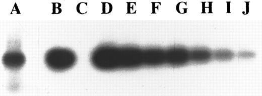 Fig. 1. Determination of copy numbers of KSHV in KS-1 cell line. Lane A, 100% KS-1 cell line DNA was amplified with GAPDH primers; lane B, 100% KS-1 cell line DNA; lane C, 100% salmon sperm DNA; lanes D through J, twofold dilutions of KS-1 cell line DNA in salmon sperm DNA, from 1:1 to 1:64. Lanes B through J were amplified with ORF 73 (open reading frame of KSHV) primers. The intensity of the band of GAPDH amplified with 100% KS-1 cell line DNA is close to the intensity of the PCR product of the ORF 73 amplified with a 1:8 dilution of KS-1 cell line DNA. The beta emissions of each band of the membrane were also counted by Ambis 4000; emissions of radioactive lanes A and G were 724 cpm and 750 cpm, respectively.