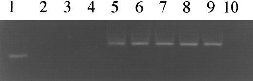 Fig. 2. Determination of sensitivity of detection of KSHV sequences. Lane 1, 100-bp DNA ladder; lane 2, K562 cell line DNA; lane 3, HL-60 cell line DNA; lane 4, distilled water. Lanes 2 through 4 served as a negative controls. Lane 5, 10 ng of KS-1 cell line DNA which is estimated to contain 24,000 copies of KSHV sequences. Lanes 5 through 9 are serial 10-fold dilutions of KS-1 cell line DNA in K562 cell line DNA. The 160-bp band that represents the nest-primer product detected up to 2.4 copies of KSHV sequences.