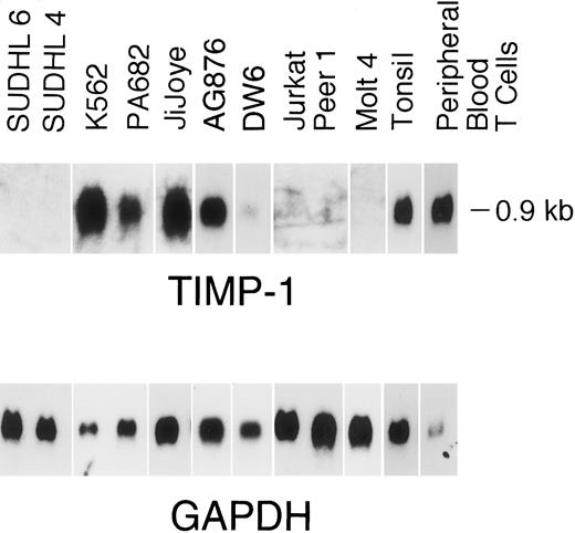Fig. 1. Northern blot analysis of TIMP-1 expression. A total of 7.5 μg of total RNA was electrophoresed on 1% wt/vol agarose-formaldehyde, transfered onto nylon filters, and hybridized with TIMP-1 and GAPDH. Filters were autoradiographed at −80°C. Radiographs were scanned by an AGFA Arcus flatbed scanner.
