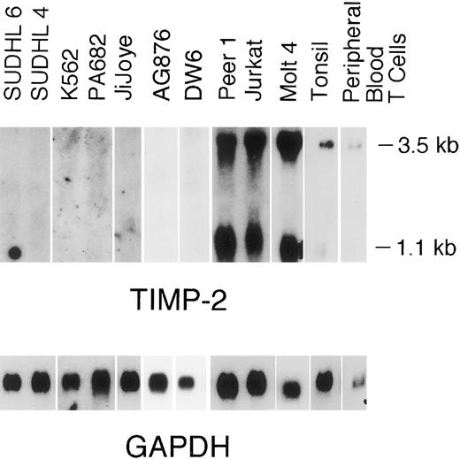 Fig. 4. Northern blot analysis of TIMP-2. A total of 7.5 μg of total RNA was electrophoresed on 1% wt/vol agarose-formaldehyde, transfered onto nylon filters, and hybridized with TIMP-2 and GAPDH. Filters were autoradiographed at −80°C. Radiographs were scanned by an AGFA Arcus flatbed scanner.