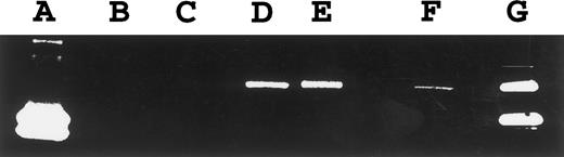 Fig. 5. Gelatin zymography for Gelatinase B. A total of 16 μL of conditioned media was electrophoresed on 10% SDS polyacrylamide gels containing gelatin. SDS was removed following electrophoresis and gels incubated to restore gelatinase activity. Gels were scanned by an AGFA Arcus flatbed scanner. Lane A, Gelatinase A; lane B, SUDHL-6; lane C, Molt-4; lane D, Jijoye; lane E, PA682; lane F, tonsil; lane G, HT1080-conditioned media (positive control for Gelatinase A and Gelatinase B.