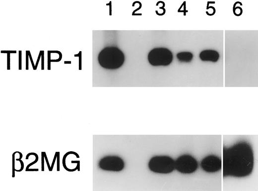 Fig. 6. RT-PCR for TIMP-1. PCR amplification of TIMP-1 cDNA was performed for 20 cycles (except isolated peripheral blood B cells, 30 cycles shown). Lane 1, PA682 (positive control); lane 2, water (negative control); lanes 3 to 5, isolated tonsillar B cells at 0 hours (lane 3), 4 hours (lane 4), and 24 hours (lane 5) stimulation with Staphylococcus aureus Cowan strain I and phorbal 12-myristate 13-acetate; lane 6, isolated peripheral blood B cells.