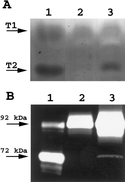 Fig. 7. (A) Reverse zymography of peripheral blood T cells. A total of 15 μL of conditioned media was electrophoresed on 15% SDS polyacrylamide gels containing gelatin and HT1080 fibroblast culture-conditioned media. SDS was removed following electrophoresis and gels incubated to restore gelatinase activity. Gels were scanned by an AGFA Arcus flatbed scanner. Lane A, HT1080 cell-conditioned media (positive control for both TIMP-1 and TIMP-2); lane B, unstimulated peripheral blood T-cell–conditioned media; lane C, IL-2/PHA-stimulated peripheral blood T-cell–conditioned media. (B) Gelatin zymography of peripheral blood T cells. A total of 16 μL of conditioned media was electrophoresed on 10% SDS polyacrylamide gels containing gelatin. SDS was removed following electrophoresis and gels incubated to restore gelatinase activity. Gels were scanned by an AGFA Arcus flatbed scanner. Lane A, HT1080 cell-conditioned media (positive control for both TIMP-1 and TIMP-2); lane B, unstimulated peripheral blood T-cell–conditioned media; lane C, IL-2/PHA-stimulated peripheral blood T-cell–conditioned media.