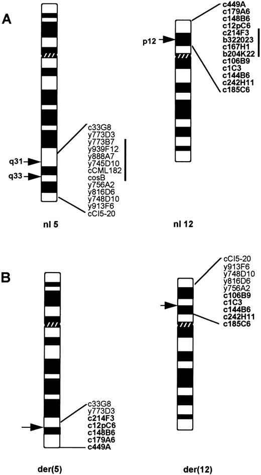 Fig. 2. (A) The probes used for the FISH studies, ordered on the 5q31q35 and 12p12p13 regions of normal chromosomes 5 and 12. (B) Probes detected on each derivative chromosome of a t(5; 12)(q31q33; p12) in pre-B ALL. The probes derived from chromosome 12 are shown in bold. Note a deletion of 5q32 region flanked by y773D3 and y756A2, as well as a loss of 12p12 sequences between c12pC6 and c106B9.