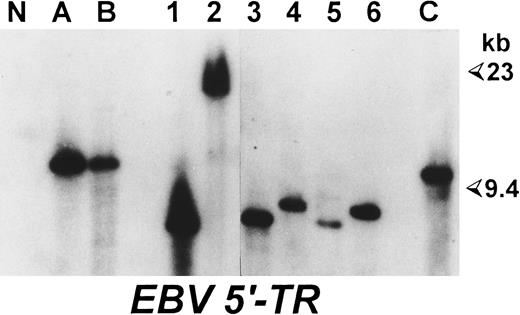 Fig. 1. Spontaneous LCLs and neoplastic cells of the same HD patient are derived from independent EBV infections. Southern blot analysis performed on BamHI-digested DNAs hybridized with a probe corresponding to a region flanking the 5′ terminal repeats of EBV genome. (A) and (B) DNA from two pathologic lymph nodes from case HD-3; 1 and 2, DNA from two spontaneous LCLs derived from one lesion of the same HD patient; 3 to 6, DNA from four LCLs obtained by spontaneous outgrowth from the PBMCs of the same patient; N, DNA from a colon carcinoma cell line; (C) DNA from an EBV+ Burkitt's lymphoma as a positive control. Sizes are in kilobases.