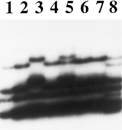Fig. 1. PCR-SSCP analysis of exon 9 of the hMLH1 gene. Lanes 1 through 8 were DNA samples from ML1, TALL1, P30OHK, A3/KAW, CEM, M5, SUM90-7, and KCL22 cell lines, respectively. Lanes 3, 5, and 8 showed abnormal migrating bands.