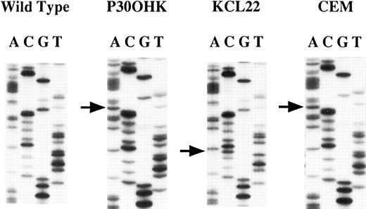 Fig. 2. Sequencing analysis of the hMLH1 mutations. The left panel represents the normal sequence of the hMLH1 exon 9. The arrows show the positions of point mutations. A nucleotide change G to A in consensus splice donor site is seen in both P30OHK and CEM. A transition of T to C at codon 259 is found in KCL22.