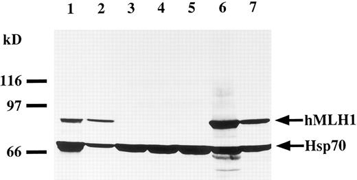 Fig. 4. Western blot analysis of the hMLH1 protein. hMLH1 protein is observed around 85 kD. The lower bands detected around 70 kD shows expression of Hsp70, as controls for the amounts and integrity of protein. Lane 1 represents normal lymphocytes derived from a normal volunteer used as a normal control. Lanes 2 through 7 are cell lysates prepared from cell lines MOLT16 (lane 2), P30OHK (lane 3), CEM (lane 4), KCL22 (lane 5), BALL1 (lane 6), and U937 (lane 7). P30OHK, CEM, and KCL22 had loss of hMLH1 protein expression with normal expression levels of Hsp70.