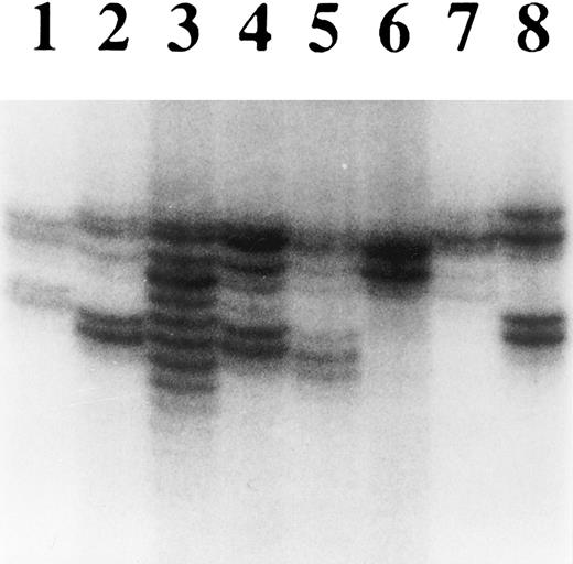 Fig. 5. Analysis of microsatellite instability of hematopoietic tumor cell lines. DNA purified from each cell line was analyzed for heterogeneity at the microsatellite locus D18S58. Lanes 1 through 8 are normal lymphocytes, U937, KCL22, CEM, P30OHK, HEL, HL60, and SKH1, respectively. Multiple alleles were particularly evident in KCL22, but could also have appeared in CEM and P30OHK.
