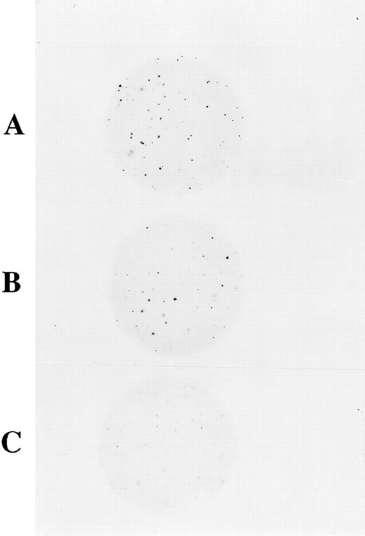 Fig. 6. NBT-dye reduction of PBHP myeloid colonies in agarose culture. These are photomicrographs at low magnification (2× final magnification) where each dark spot represents a colony, containing strongly oxidase positive cells that have reduced NBT to formazan. (A) Colonies derived from normal CD34+ progenitor cells showing positive NBT-dye reduction to blue-black formazan. (B) Colonies derived from p67phox deficient CGD patient CD34+ cells transduced with MFGS-p67phox clone 20 exhibiting strong NBT-dye reduction of many colonies. (C) Colonies derived from sham transduced patient CD34+ cells, which exhibit only weak background NBT-dye reduction.