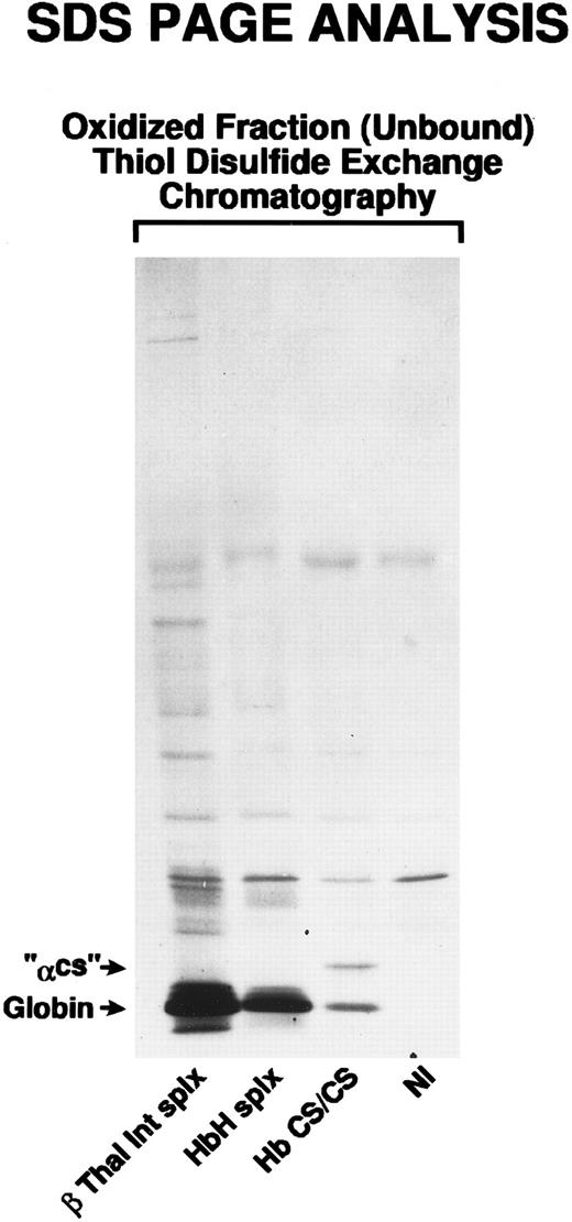 Fig. 6. Thiol-disulfide exchange chromatography was performed on a normal control, a β-thalassemia intermedia patient who had been splenectomized, an HbH patient who had been splenectomized, and a patient with homozygous HbCS/CS. The unbound fraction was analyzed by SDS-PAGE and the αCS was identified at a position consistent with a molecular weight of 19 kD. Note the presence of globin bands at the bottom of the gel. These have previously been shown to be αA in β-thalassemia intermedia and βA in HbH.2