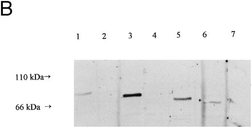 Fig. 1. PKC in erythrocytes. (A) Translocation of PKC activity from cytosol to membrane in uninfected erythrocytes exposed to DMSO (□) or 500 nmol/L PMA (▨) for 15 minutes. PKC activity given is the total kinase activity minus activity measured in the absence of lipid activators (PMA/phosphatidyl-serine/Triton-X–100 mixed micelles) and the presence of 20 μmol/L PKC.19-36 Activities represent the mean of duplicate assays + range. This result is representative of six separate experiments. (B) Western blot of whole cell lysates from uninfected cells, prepared and separated on a 10% acrylamide gel (107 cell equivalents/lane) as described in Materials and Methods. Blots were incubated with monoclonal antibodies as follows: lane 1, anti-PKCα at 0.05 μg/mL; lane 2, anti-PKCβ at 0.16 μg/mL; lane 3, anti-PKCγ at 0.25 μg/mL; lane 4, anti-PKCε at 0.5 μg/mL; lane 5, anti-PKCθ at 1 μg/mL; lane 6, anti-PKC ι at 1.6 μg/mL and lane 7, anti-PKCλ at 1.6 μg/mL. No bands were detected in parallel blots incubated with control antibodies or second layer only (not shown).