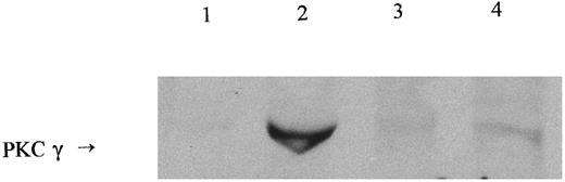 Fig. 3. Western blotting of membrane PKC in PMA-treated IRBC 5 × 108 RBC or IRBC (70% parasitized) were incubated with or without PMA for 15 minutes and membranes prepared as described in Materials and Methods. Membrane proteins (150 μg/lane) were separated on a 10% acrylamide gel. Lane 1, untreated RBC; lane 2, RBC + PMA; lane 3, untreated IRBC; lane 4, IRBC + PMA. Arrow indicates a band cross-reacting with the PKC-specific antibody MC5. The identity of this band was confirmed by reprobing with specific anti-PKCγ antibody (not shown).