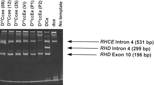 Fig. 3. Multiplex RHD PCR of genomic DNA derived from DVI phenotype individuals. gDNA derived from peripheral blood lymphocytes isolated from individuals expressing DVICcee and DVIccEe phenotypes were analyzed using a RHD intron 4/exon 10 multiplex assay (see Materials and Methods). Six different individuals with the DVI phenotype are illustrated (donor identification in brackets). A D-positive (DCe), D-negative, and no template controls are also shown. PCR products were analyzed by electrophoresis on 6% polyacrylamide gels.