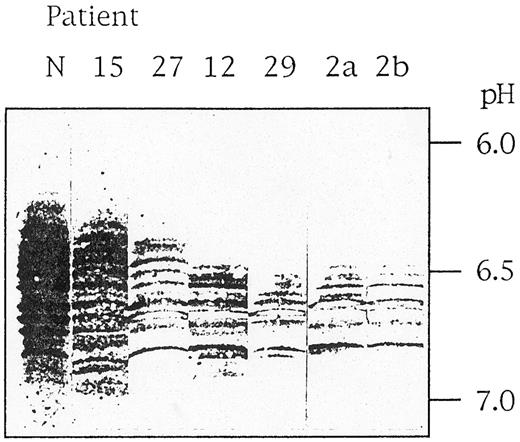 Fig. 2. Pattern of PK-R immunoreactive polypeptides in RBCs of PKD patients. Stroma-free hemolysates of a normal individual (N) and six PKD patients (no. 15, 27, 12, 29, 2a, and 2b) were subjected to isoelectric focusing in ultrathin polyacrylamide gels, and immunoreactive bands were visualized using a monospecific antibody against PK-R.5