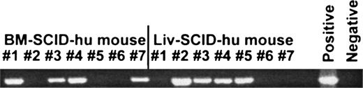 Fig. 3. Detection of neo gene by PCR analysis of PB from SCID mice transplanted with HFBM or HFL cells transduced with a retroviral vector. HFBM and HFL cells were transduced with LN, a retroviral vector containing the neo gene as described in the Materials and Methods section and then transplanted into irradiated SCID mice. One month later the mice were bled and the PBMC were assessed for incorporated neo gene by PCR. An ethidium bromide-stained gel showing the presence of the neo primer pair-amplified product in the PBMC of BM-SCID-hu mice (n = 7 mice) and Liv-SCID-hu mice (n = 7 mice) is shown.