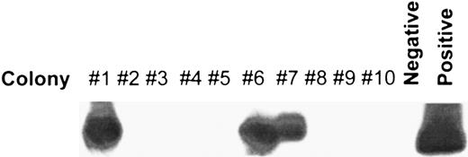Fig. 4. Detection of neo gene by PCR analysis of primary colonies isolated from the BM of SCID mice transplanted with HFBM transduced with a retroviral vector. HFBM was transduced with LN, a retroviral vector containing the neo gene as described in the Materials and Methods section and then transplanted into irradiated SCID mice. Two months later the BM of the mice was procured, placed in clonogenic assays, and the colonies were assessed for incorporated neo gene by PCR. A representative Southern blot using an intervening sequence probe specific for the neo primer pair-amplified product in randomly picked colonies is shown.