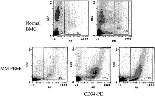 Fig. 1. Expression of CD34 on MM PBMC compared with normal BM. Cells from two individual normal BM (top row) or 3 MM patients (bottom row) were stained with a direct conjugate of CD34-PE, followed by a scatter plot of CD34 versus side scatter. The rectangle indicates those cells identified as CD34+.