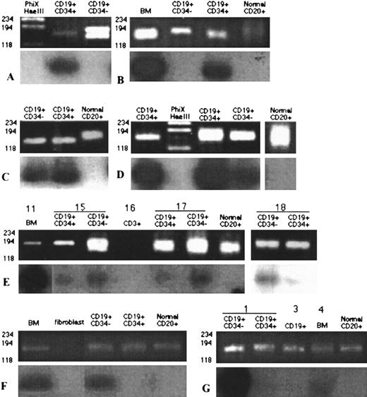 Fig. 5. CD34+ and CD34− B cells in the blood of myeloma patients have IgH rearrangements identical to those of autologous BM plasma cells. (A) through (G) represent analysis of sorted lymphocyte subsets from 7 different patients. In each panel the top half shows CDR3 rearrangements amplified by nested PCR from 103 sorted cells of the indicated PBMC subsets, using consensus primers to FR2a and JH1 followed by a second-stage PCR amplification using consensus primers to FR2b and JH2.7 The bottom half of each panel shows the hybridization of amplified products with end-labeled patient-specific ASO probes. Patient A was post chemotherapy with stable disease. Patients B through D were in relapse. Patient E was analyzed at relapse (no. 11), during his second round of chemotherapy (no. 15) where a partial response occurred, and in the progressive stage of disease (nos. 17 and 18). Patient F was at diagnosis and untreated. Patient G had received the first two cycles of chemotherapy after diagnosis.