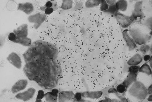 Fig. 1. Autoradiographic analysis of 125I-Tpo binding to normal human bone marrow mononuclear cells. Original magnification × 100.