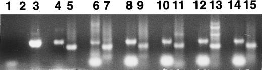 Fig. 5. RT-PCR analysis of Mpl receptor mRNA. RT-PCR was performed to detect the presence of c-mpl or GAPDH mRNA in HEL cells (lanes 4 and 5), K562 cells (lanes 6 and 7), CD34+ human marrow cells (lanes 8 and 9), and colonies derived from day-5 (lanes 10 and 11), day-7 (lanes 12 and 13), and day-10 (lanes 14 and 15) BFU-E progeny. The primers used for amplification were specific for the extracellular domain of Mpl (lanes 3, 4, 6, 8, 10, 12, and 14) or for GAPDH (lanes 2, 5, 7, 9, 11, 13, and 15). Cloned human mpl cDNA was used as a positive control (lane 3). Negative controls were performed using no input cDNA (lanes 1 and 2).