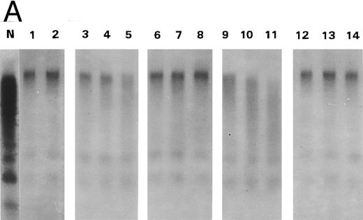 Fig. 1. Proteolytic cleavage of recombinant vWF expressed in COS-7 cells. (A) Autoradiograph of a 1.5% SDS agarose gel probed with 125I-labeled anti-vWF. Lane N, vWF in normal plasma. Lanes 1 and 2, recombinant WT vWF and R834W vWF mutant in the culture media of COS-7 cells. Lanes 3 through 5 and lanes 9 through 11, WT vWF (lanes 3 through 5) and R834W vWF mutant (lanes 9 through 11) after 60 minutes of incubation at 37°C with the plasma proteinase at 0.1 U/mL (lanes 3 and 9), 0.2 U/mL (lanes 4 and 10), and 0.4 U/mL (lanes 5 and 11). Lanes 6 through 8 and lanes 12 through 14, same as lanes 3 through 5 and lanes 9 through 11, respectively, except that the incubation was performed without prior recalcification of the vWF samples. (B) Representative densitometric tracings of lanes 1, 2, 5, and 11 in (A). (▴) The sample starting point; (▾) the peaks of the tracings. (C) The normalized peak distances of the lanes shown in (A) for recalcified WT vWF (▵) or R834W mutant (▴) and nonrecalcified WT vWF (□) or R834W mutant (•) were plotted against the proteinase concentration that the vWF sample was exposed to.