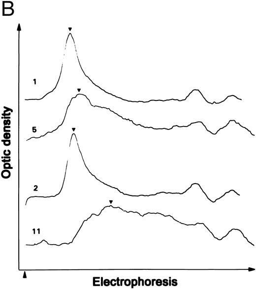 Fig. 1. Proteolytic cleavage of recombinant vWF expressed in COS-7 cells. (A) Autoradiograph of a 1.5% SDS agarose gel probed with 125I-labeled anti-vWF. Lane N, vWF in normal plasma. Lanes 1 and 2, recombinant WT vWF and R834W vWF mutant in the culture media of COS-7 cells. Lanes 3 through 5 and lanes 9 through 11, WT vWF (lanes 3 through 5) and R834W vWF mutant (lanes 9 through 11) after 60 minutes of incubation at 37°C with the plasma proteinase at 0.1 U/mL (lanes 3 and 9), 0.2 U/mL (lanes 4 and 10), and 0.4 U/mL (lanes 5 and 11). Lanes 6 through 8 and lanes 12 through 14, same as lanes 3 through 5 and lanes 9 through 11, respectively, except that the incubation was performed without prior recalcification of the vWF samples. (B) Representative densitometric tracings of lanes 1, 2, 5, and 11 in (A). (▴) The sample starting point; (▾) the peaks of the tracings. (C) The normalized peak distances of the lanes shown in (A) for recalcified WT vWF (▵) or R834W mutant (▴) and nonrecalcified WT vWF (□) or R834W mutant (•) were plotted against the proteinase concentration that the vWF sample was exposed to.