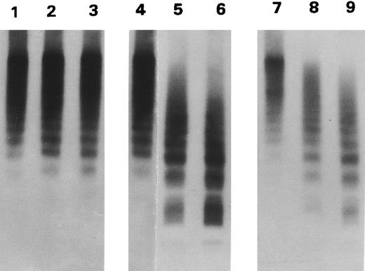 Fig. 2. Proteolytic cleavage of recombinant vWF expressed in BHK cells. Autoradiograph of a 1.5% SDS agarose gel probed with 125I-labeled anti-vWF. Recombinant WT vWF (lanes 1 through 3), R834W vWF mutant (lanes 4 through 6), and R834Q vWF mutant (lanes 7 through 9), purified from the culture media of transfected BHK cells, were incubated with either TBS (lanes 1, 4, and 7) or with 1 U/mL of the plasma proteinase for 15 minutes (lanes 2, 5, and 8) and 30 minutes (lanes 3, 6, and 9).