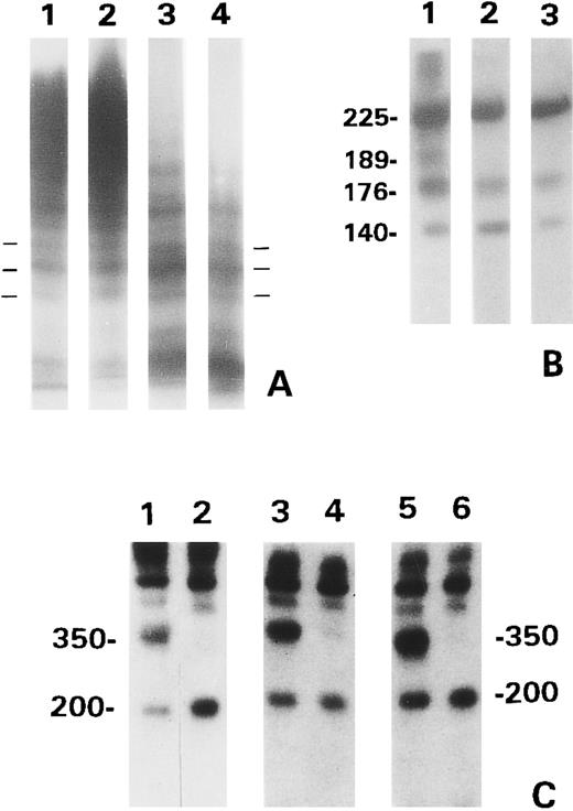 Fig. 3. Gel analysis of the proteolytic products generated from the BHK recombinant vWF. (A) Normal plasma vWF (lane 1) and the proteolytic products of WT vWF treated with guanidine HCl (lane 2) and R834W (lane 3) and R834Q mutants (lane 4) analyzed in SDS 1.6% low gelling temperature agarose gel. The horizontal bars marked one of triplet multimers. (B) Proteolytic fragments of WT vWF/guanidine HCl (lane 1) and R834W (lane 2) and R834Q mutants, analyzed by 6% SDS-PAGE under reducing conditions. The blot was probed with anti-vWF and 125I-labeled goat antirabbit IgG. The numbers indicate the MW (×10−3). (C) Proteolytic fragments of WT vWF/guanidine HCl (lanes 1 and 2), R834W mutant (lanes 3 and 4), and R834Q mutant (lanes 5 and 6), analyzed by 6% SDS-PAGE under nonreducing conditions. The vWF products were either analyzed directly (lanes 1, 3, and 5) or subjected to immunoisolation with monoclonal VP-1 before electrophoresis (lanes 2, 4, and 6). The blots were probed as in (B).