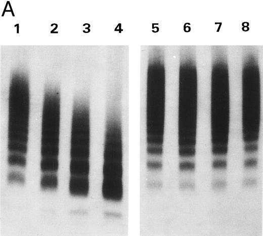 Fig. 5. Inhibition by doxycycline of vWF proteolysis. (A) Doxycycline-inhibited proteolytic cleavage of R834W vWF mutant. Autoradiographs of a 1.5% SDS agarose gels probed with 125I-labeled anti-vWF. Lanes 1 through 4 and lanes 5 through 8, R834W vWF mutant incubated with 1 U/mL proteinase without and with 2 mmol/L doxycycline, respectively, for 15 minutes (lanes 1 and 5), 30 minutes (lanes 2 and 6), 60 minutes (lanes 3 and 7), and 90 minutes (lanes 4 and 8). (B) Doxycycline prevented the decrease of R834W vWF Rcof activity by the plasma proteinase. vWF ristocetin cofactor (RCof) was expressed as the percentage of the vWF incubated with TBS. (▪) R834W vWF + proteinase treated with 2 mmol/L doxycycline. (♦) R834W vWF + proteinase.