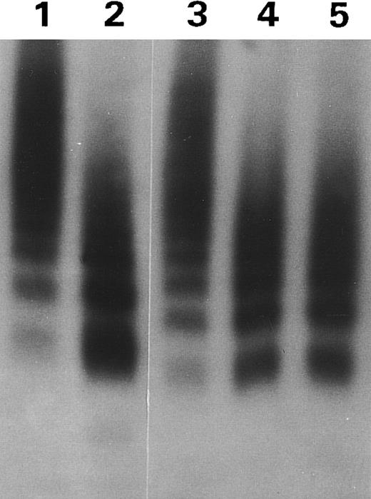 Fig. 7. MoAb VP-1 decreased proteolytic cleavage of the R834W vWF mutant. Autoradiograph of a 1.5% SDS agarose gel showing the size distribution of the vWF mutant incubated with TBS (lane 1) or the plasma proteinase after treatment, respectively, with 1/10 TBS (lane 2), VP-1 (lane 3), M13 (lane 4), or M31 (lane 5).