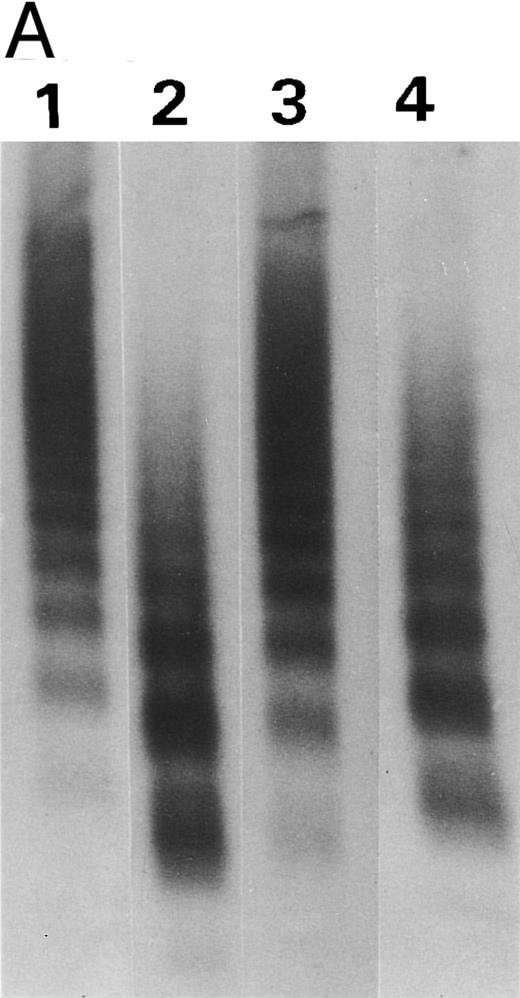 Fig. 8. Synthetic peptide SP-2 (described in the Materials and Methods) reversed the inhibitory activity of antibody VP-1. (A) An autoradiograph of a 1.5% SDS agarose gel showing the size distribution of the R834W vWF mutant incubated with TBS (lane 1), the plasma proteinase (lane 2), the plasma proteinase in the presence of VP-1 (lane 3), and the plasma proteinase in the presence of VP-1 and 1 mmol/L SP-2. (B) Concentration dependence of SP-2 reversal of VP-1 inhibitory activity. VP-1 (90 μmol/L mouse IgG) treated with designated concentrations of SP-2 was added to the vWF mutant before the plasma proteinase. The intensity of the 200-kD band generated from the vWF was plotted against the SP-2 concentration on a log scale.