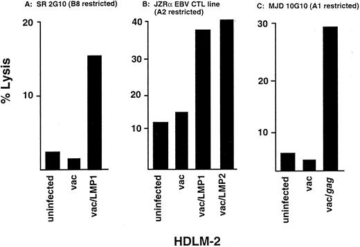 Fig. 4. Lysis of HDLM-2 expressing viral proteins by CTL. Virus-specific lines and clones were generated from normal, healthy donors who shared HLA alleles with HDLM-2 by stimulating PBMC with autologous APC infected with vac recombinants. Lysis of HDLM-2 after infection with vac recombinants was determined in a standard CRA. (A) Lytic activity of a HLA-B8–restricted LMP1-specific CTL clone, 2G10 for HDLM-2 target cells infected with vac/LMP1, vac alone, or uninfected at an E:T of 2:1. (B) Lytic activity of an EBV-reactive CTL line generated from a HLA-A2,B13,18 individual for HDLM-2 target cells infected with vac/LMP1, vac/LMP2, vac alone, or uninfected at an E:T of 10:1. (C) Lytic activity of a HLA-A1–restricted HIVgag-specific CTL clone for HDLM-2 target cells infected with vac/gag, vac alone, or uninfected at an E:T of 10:1.