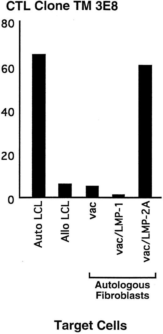 Fig. 6. Representative LMP2-specific CD8+ CTL isolated from a HD patient. Polyclonal lines were generated by stimulating PBMC with autologous LMP2-expressing cells. Responding cells were cloned by limiting dilution in the presence of autologous LCL. Clones were screened for specific lysis of autologous LCL in a standard CRA. Specificity for the LMP2 protein was determined in a CRA by lysis of autologous fibroblasts infected with vac/LMP2, but not cells infected with vac/LMP1 or vac alone. Effector cells were added to the plates at an E:T of 10:1.