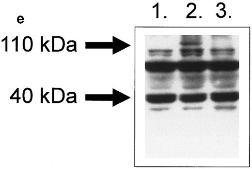 Fig. 5. Fas− cells express FasL after strong cross-linking of HLA class II molecules. Fas− cells were incubated for 96 hours with (a) L227 XL, (b) L227, (c) goat antimouse F(ab′)2 , or (d) W6.32 XL. The level of expression of nonstimulated cells is also shown as an unfilled profile. FACS profiles were obtained according to the method used in Fig 1a to d. (e) FasL detection after SDS-PAGE in nondenaturing conditions as a 110-kD trimer in lane ii. Lane 1, nonstimulated; lane 2, L227 XL; lane 3, W6.32 XL.