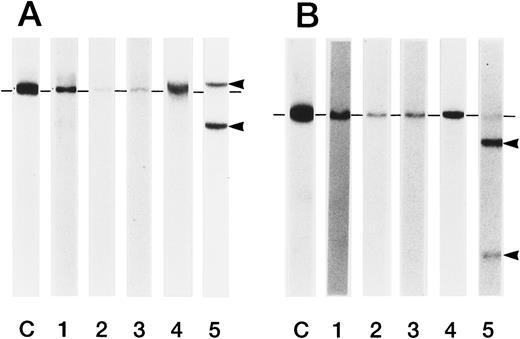 Fig. 4. Rearrangement of Ig heavy chain in HBLD and in HCL-Japanese variant. DNA extracted from mononuclear cells was digested with (A) EcoRI or (B) HindIII restriction enzyme and hybridized to a JH probe. Rearranged bands are indicated by arrows, and germ lines are indicated by dashes. Lane C, normal placenta; lanes 1 through 4, HBLD (cases no. 1 through 4); lane 5, HCL-Japanese variant.