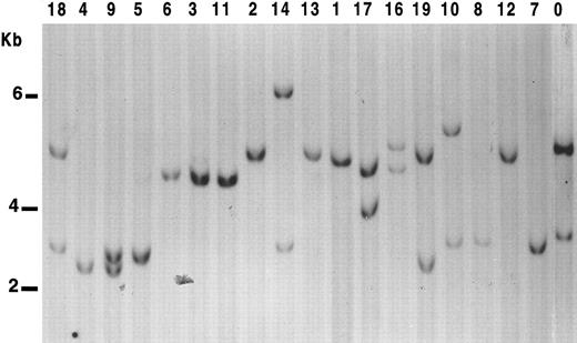 Fig. 1. LOH analysis at 17p13.3 in B-PLL cases. Genomic DNA from the samples studied were digested with Pst I, subjected to Southern blot, and probed with the clone p144-D6. Cases were scored positive for LOH when displaying only one allelic band with both probes. Nine of the B-PLL cases show only one band with p144-D6. However, in case no. 8, two bands were observed with pYNZ22 probe. Lane 0, control DNA from a normal sample.