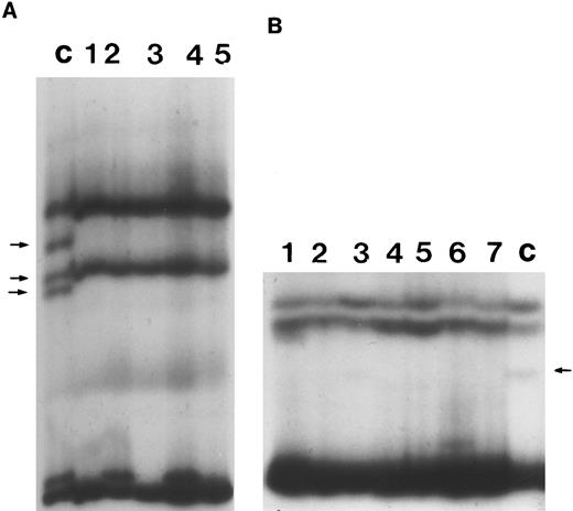 Fig. 3. Representative SSCP analysis of genomic DNA from B-PLL showing absence of mutations in exons 4 and 10 of p53. SSCP was performed as described in the Materials and Methods. Abnormally migrating conformers in control DNAs are indicated with arrows. (A) SSCP of exon 4. Lane C, control DNA with known missense mutation at codon 102 of p53. Lanes 1 through 5, DNA from individual B-PLL cases. (B) SSCP of exon 10. Lane C, control DNA with a known missense mutation at codon 336 of p53. Lanes 1 through 7, DNA from individual B-PLL cases.