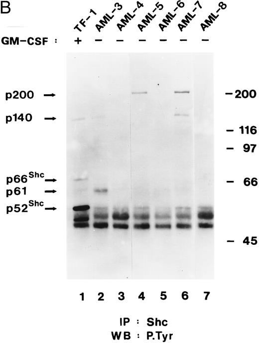 Fig. 4. Shc and p140 are constitutively phosphorylated on tyrosine in AML cells. (A) Cell lysates from unstimulated (−) or hGM-CSF–stimulated (+) TF-1 cells and lysates of primary leukemia cells obtained from two patients with AML (AML-1 and AML-2), CLL, and a lysate of PBMCs obtained from a healthy donor were immunoprecipitated with anti-Shc antibodies and subjected to antiphosphotyrosine immunoblotting (P.Tyr). (B) Anti-Shc immunoprecipitates of lysates from hGM-CSF–stimulated TF-1 cells (lane 1) and primary AML (AML-3 through AML-8; lanes 2 through 7) were analyzed by antiphosphotyrosine immunoblotting. The positions of p52Shc, p66Shc, p61, p140, and p200 are indicated on the left. Molecular weight marker bands are indicated on the right.